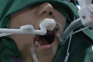 World first autonomous dental implant robot put into use in China
