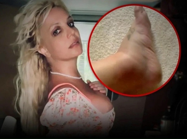 ⚡"У БРИТНИ СПИРС БОЛЕЗНЬ, которая с каждым днем...