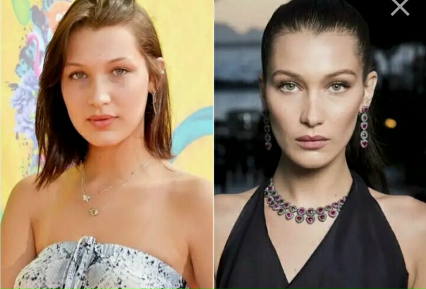 Белла хадид до и после пластики фото Белла хадид до и после пластики фото