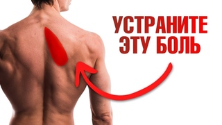 Болит ромбовидная мышца Как устранить боль под лопаткой